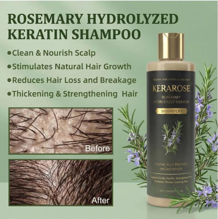 Kerarose Rosemary Shampoo For Hair Growth (Buy 1 Get 1 Free) (PL)