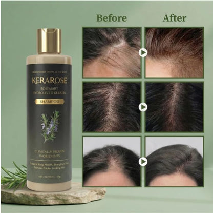 Kerarose Rosemary Shampoo For Hair Growth (Buy 1 Get 1 Free) (PL)