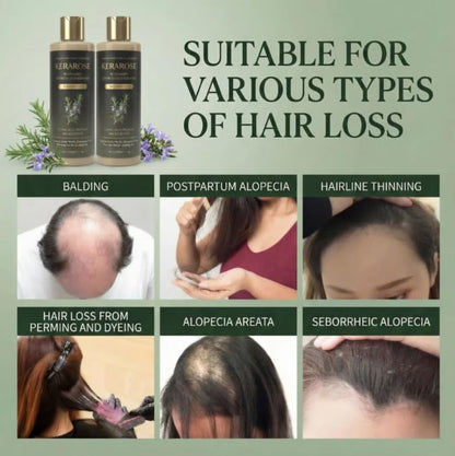 Kerarose Rosemary Shampoo For Hair Growth (Buy 1 Get 1 Free) (PL)